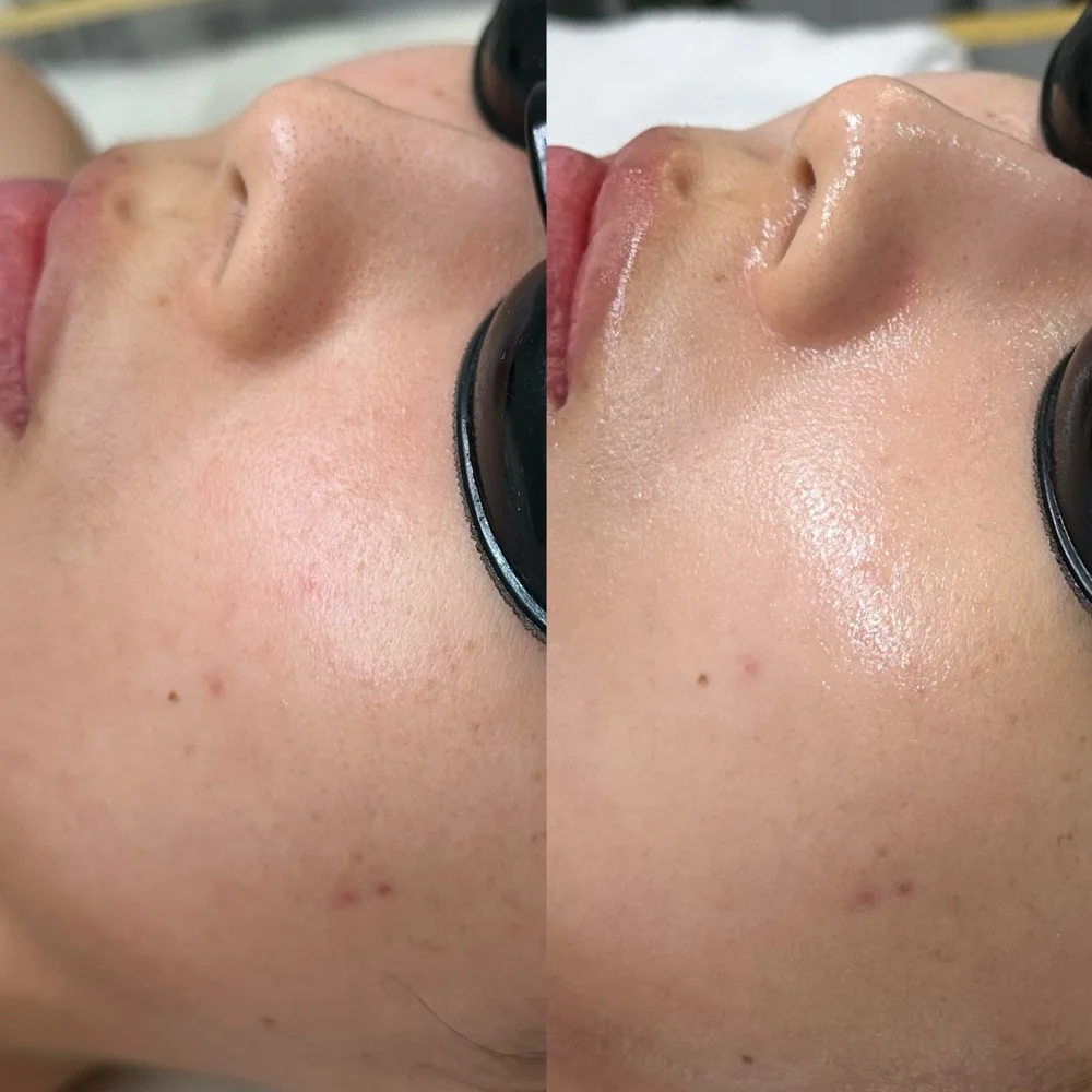 LDM water lifting result